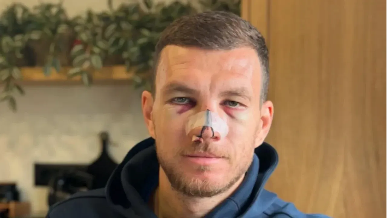 Edin Dzeko’dan “Ya Hep Ya Hiç” Mesajı! Sakatlandı, Derbiyi Kaçırabilir
