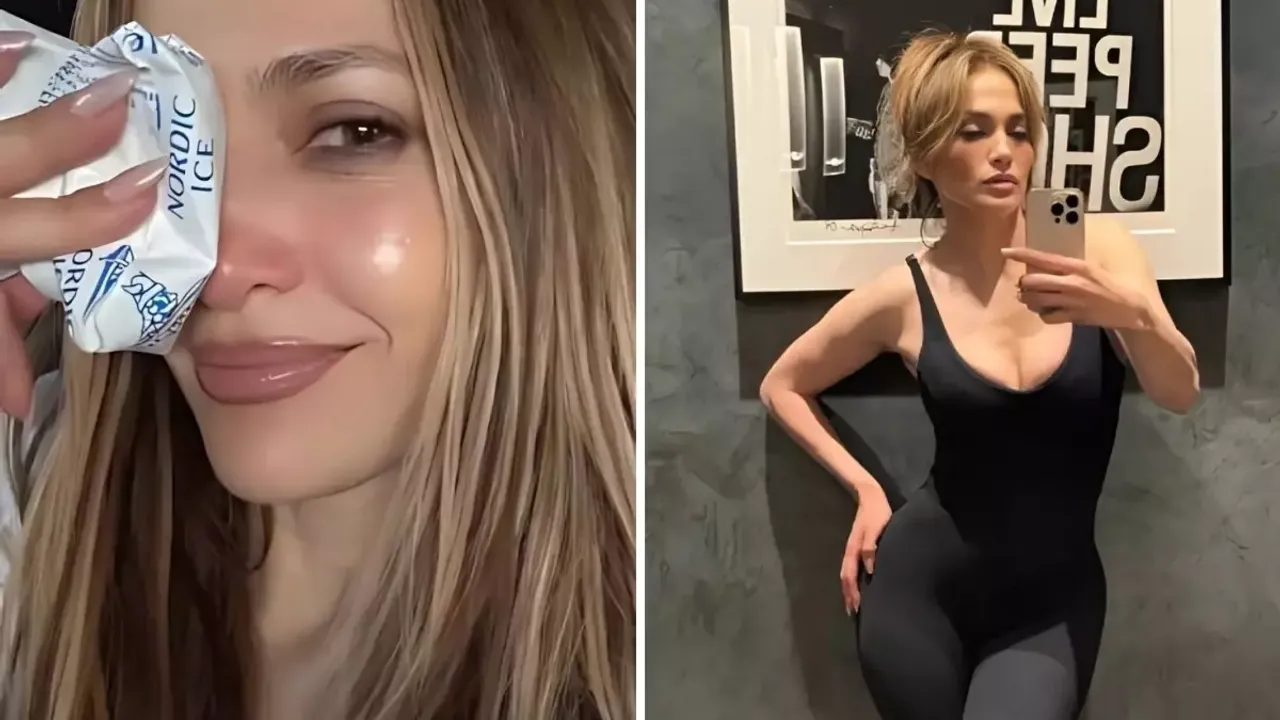 Jennifer Lopez Provalarda Yaralandı! Burnuna Dikiş Atıldı, Sunuculuğa Devam Edecek mi?