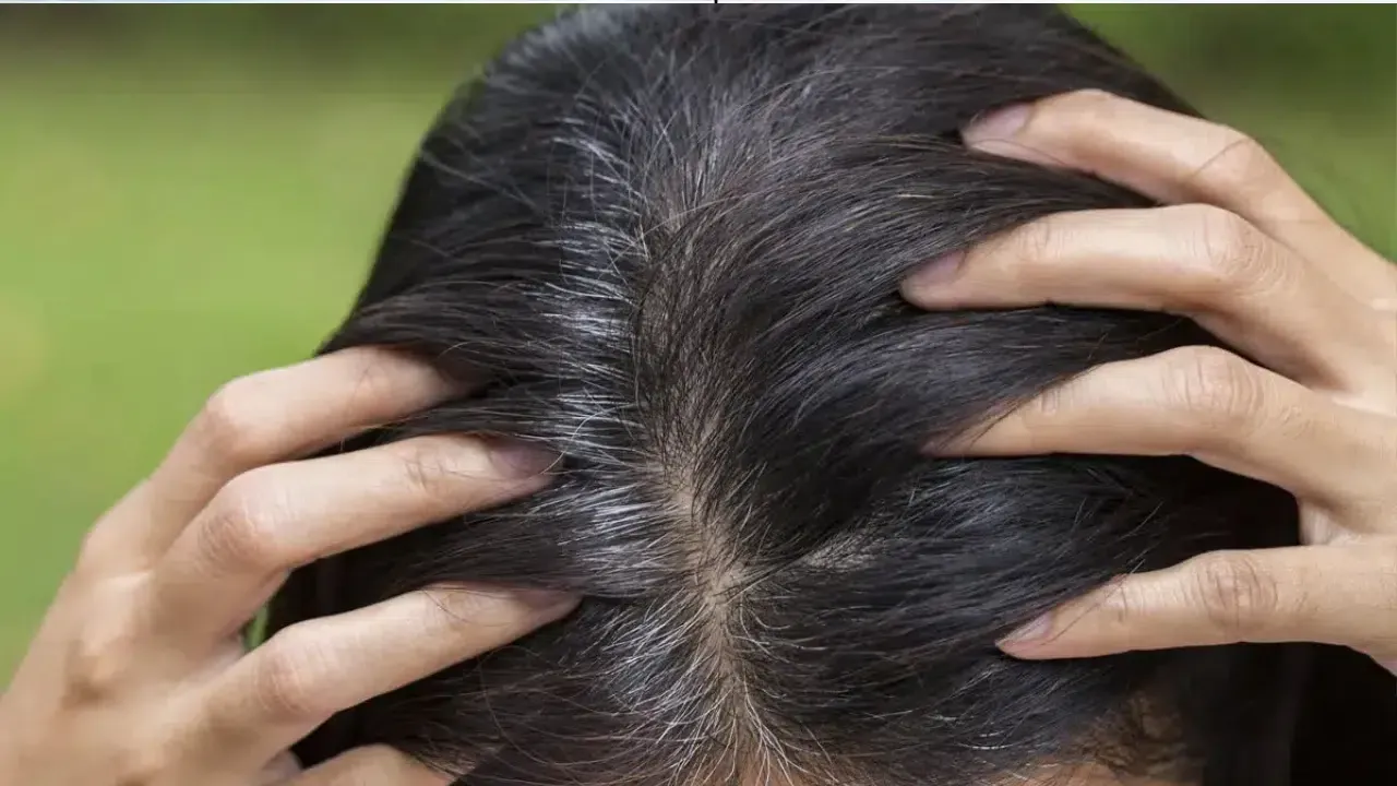 Saç neden beyazlar, stres saç beyazlamasını etkiler mi, genç yaşta saç beyazlamasının sebepleri neler? Dermatolog Dr. Aamna Adel açıkladı