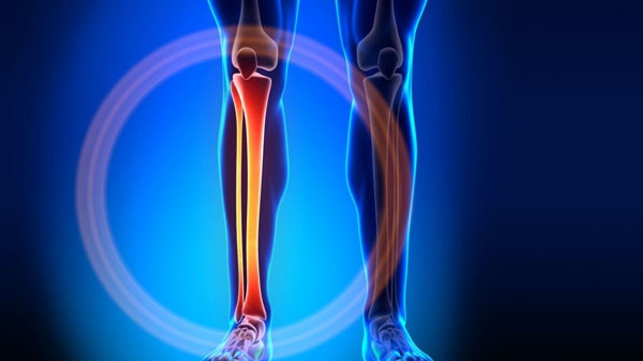 Kaval kemiği nedir? Kaval kemiği ağrısı nedir, neden olur ve nasıl geçer?