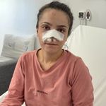 Burnu koparılan kadın o anları anlattı: "Bir anda boynuma sarılıp ısırdı"