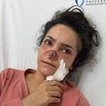 Manisa'da dehşet gecesi: Tartıştığı eşinin burnunu ısırarak kopardı!