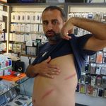 Hatay’da kira kavgasında çivili sopalar kullanıldı: “Çocuğumun gözleri önünde kavga yaşandı”