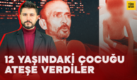 12 yaşındaki Batuhan’ı kolonya dökerek ateşe verdiler! Dehşete düşüren olay