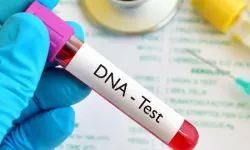 DNA testi nasıl yapılır?