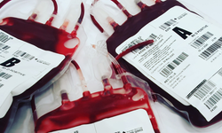 Hematoloji nedir, hangi hastalıklara bakar?