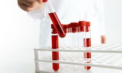 Hemogram NEU nedir? Hemogram NEU yüksekliği nedir?