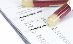 Hemogram MCV nedir, kanda MCV düşüklüğü ne demek?