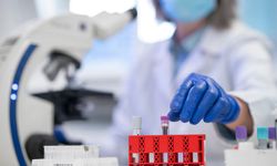 MCV düşüklüğü ve yüksekliği nedir? Belirtileri, nedenleri ve tedavisi nelerdir? MVC kan testi ne zaman yapılır?