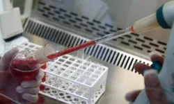 İnsanlığın en nadir kanı: Yalnızca 43 kişide var