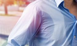 Aşırı Terleme (Hiperhidroz) neden olur? Terlemeye ne iyi gelir?