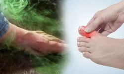 Ayakta mantara doğal çözüm için bu ürünleri kullanın