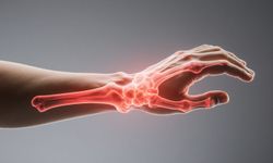 Carpal Tunnel Syndrome nedir?