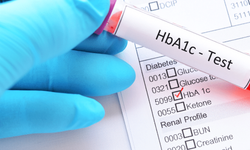 Glike Hemoglobin (HbA1c) nedir? Nasıl ölçülür, hangi değerler normaldir?