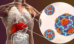 Hepatit B nedir? Hepatit B belirtileri nelerdir, nasıl bulaşır?