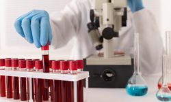 Hormon testi nedir, nasıl yapılır? Sağlık için önemi ve detayları