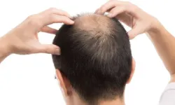 Kellik artık tarihe karışacak