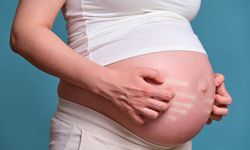Kolestaz nedir, belirtileri ve tedavi yöntemleri nelerdir? Kolestaz bebeğe zarar verir mi?