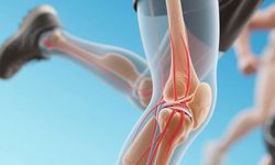 Kondromalazi patella (koşucu dizi) nedir? Belirtileri ve tedavisi