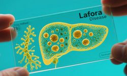 Lafora Hastalığı nedir?