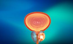 Prostat nedir? Prostat belirtileri nelerdir?