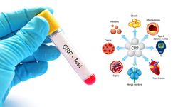 CRP değeri kaç olmalıdır? CRP testi neden yapılır? Kanda CRP yüksekliği ne anlama gelir?