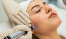Dermapen nedir? Dermapen uygulaması ne işe yarar? Faydaları ve sonuçları