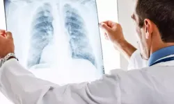 Parankim nedir, parankim ekosu ne anlama gelir?