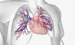 Pulmoner hipertansiyon nedir? Pulmoner hipertansiyon belirtileri nelerdir?