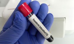 Transferrin satürasyonu nedir? Transferrin satürasyonu düşüklüğü ve yüksekliği ne anlama gelir?