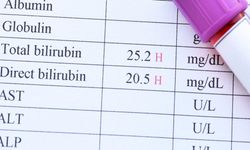 Bilirubin nedir? Bilirubin yüksekliği ve düşüklüğü ne anlama gelir?