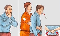 Heimlich manevrası nedir? Heimlich manevrası nasıl uygulanır?