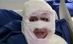 Kadıköy’de genç kadını ateşe verdiği iddia edilen saldırgan tutuklandı