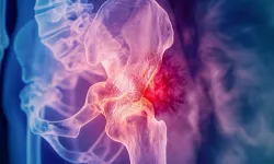 Kanser tarihe mi karışıyor? İşte o rapor!