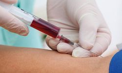 Lüteinleştiren hormon nedir? LH hormonu ne işe yarar?