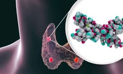 Parathormon yüksekliği nedir, neden olur? Parathormon normal değeri kaç olmalı?