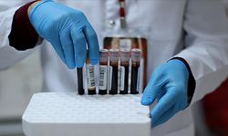 Hemogram HGB düşüklüğü nedir, nedeni ne HGB düşüklüğü için ne yapılmalı, HGB tahlili ne? Normal HGB değeri kaç olmalı?