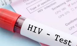 Anti HIV nedir? Anti HIV pozitif ve negatif ne anlama gelir?