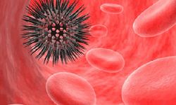 Hodgkin lenfoma nedir, belirtileri, nedenleri ve tedavi yöntemleri nelerdir?