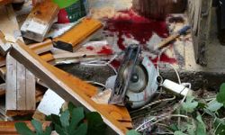 76 yaşındaki adam bacağını elektrikli testereye kaptırdı: Olay yerine gelen torunu gözyaşlarına boğuldu!