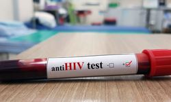 Anti-hiv negatif nedir?