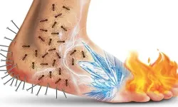 Diyabetik nöropati nedir, neden olur, belirtileri nelerdir?