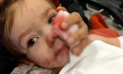 Ankara’da pitbull saldırısına uğrayan minik Efe ile ilgili yeni gelişme