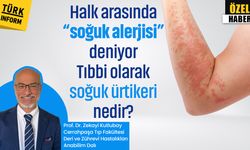 Halk arasında "soğuk alerjisi" deniyor: Tıbbi olarak soğuk ürtikeri nedir?