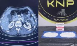 Kayseri'de film gibi operasyon: Midesinde uyuşturucu ile Türkiye'ye girdi!