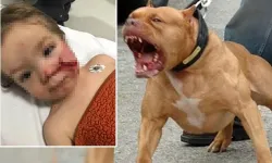 Ankara'da pitbull saldırısında iki çocuğun yaralanması sonrası köpek sahibi tutuklandı!