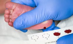 Topuk kanı nedir? Topuk kanı nasıl alınır?