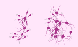 Aglütinasyon ne demek, hangi durumlarda ortaya çıkar?