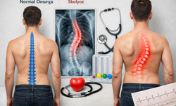 Sizde de skolyoz olabilir, skolyoz sessiz ilerliyor!