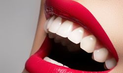 Gülüşünü değiştirmek isteyenler buraya: Diş estetiğinde trend olan uygulamalar neler?